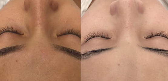 CẤY PUMKIN( BÍ ĐỎ)